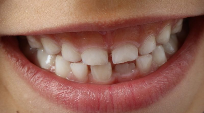Návyky, které ničí naše zuby